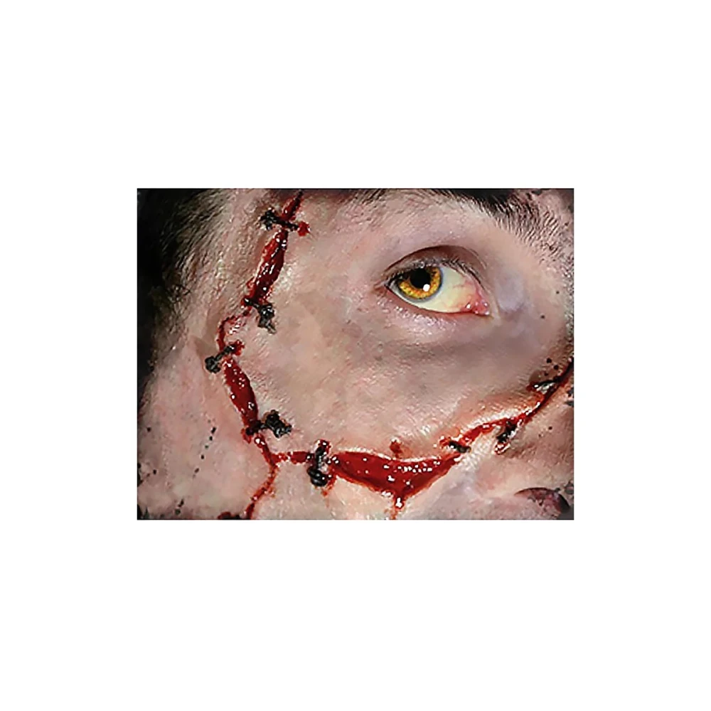 Narbe - Stiche