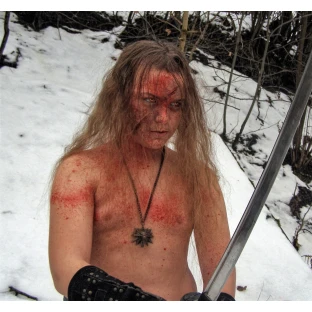 Scars - Lacerations
